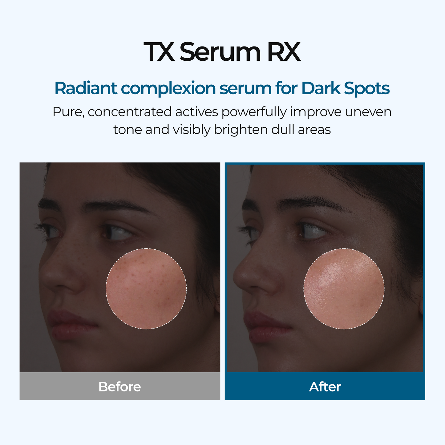 Ampule TX Rx