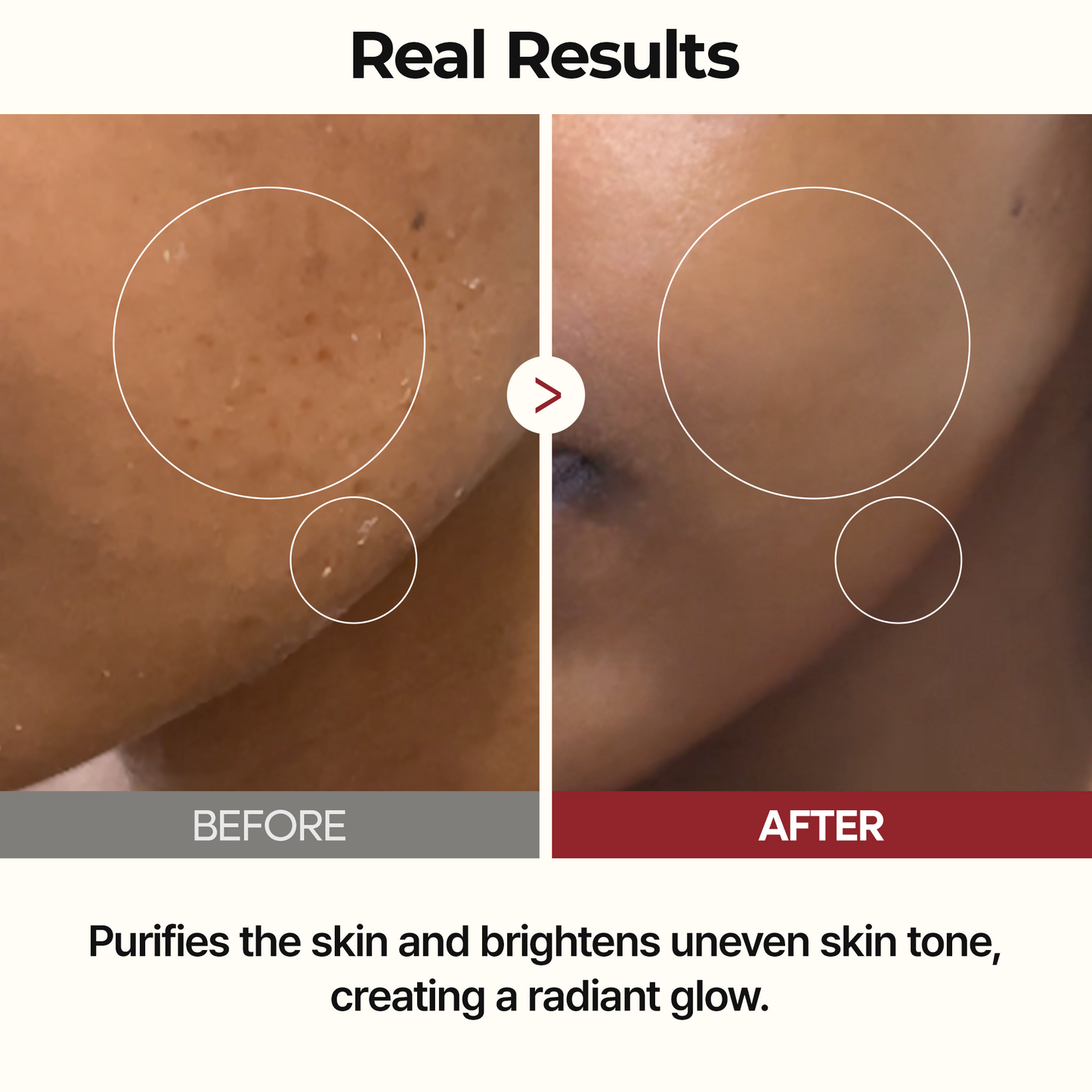 Rizs tonik Peel Shot Glow