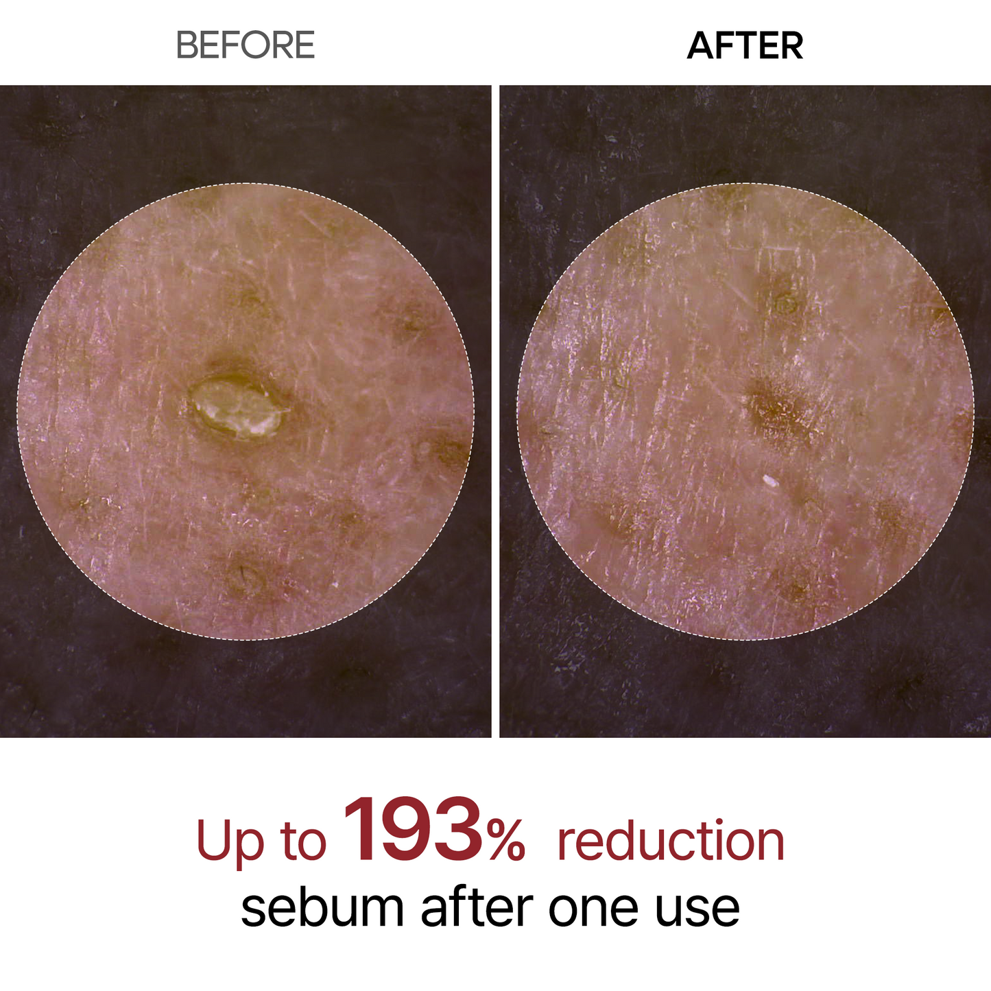 Peel Shot Glow Λευκή Ρυζιού Αμπούλα
