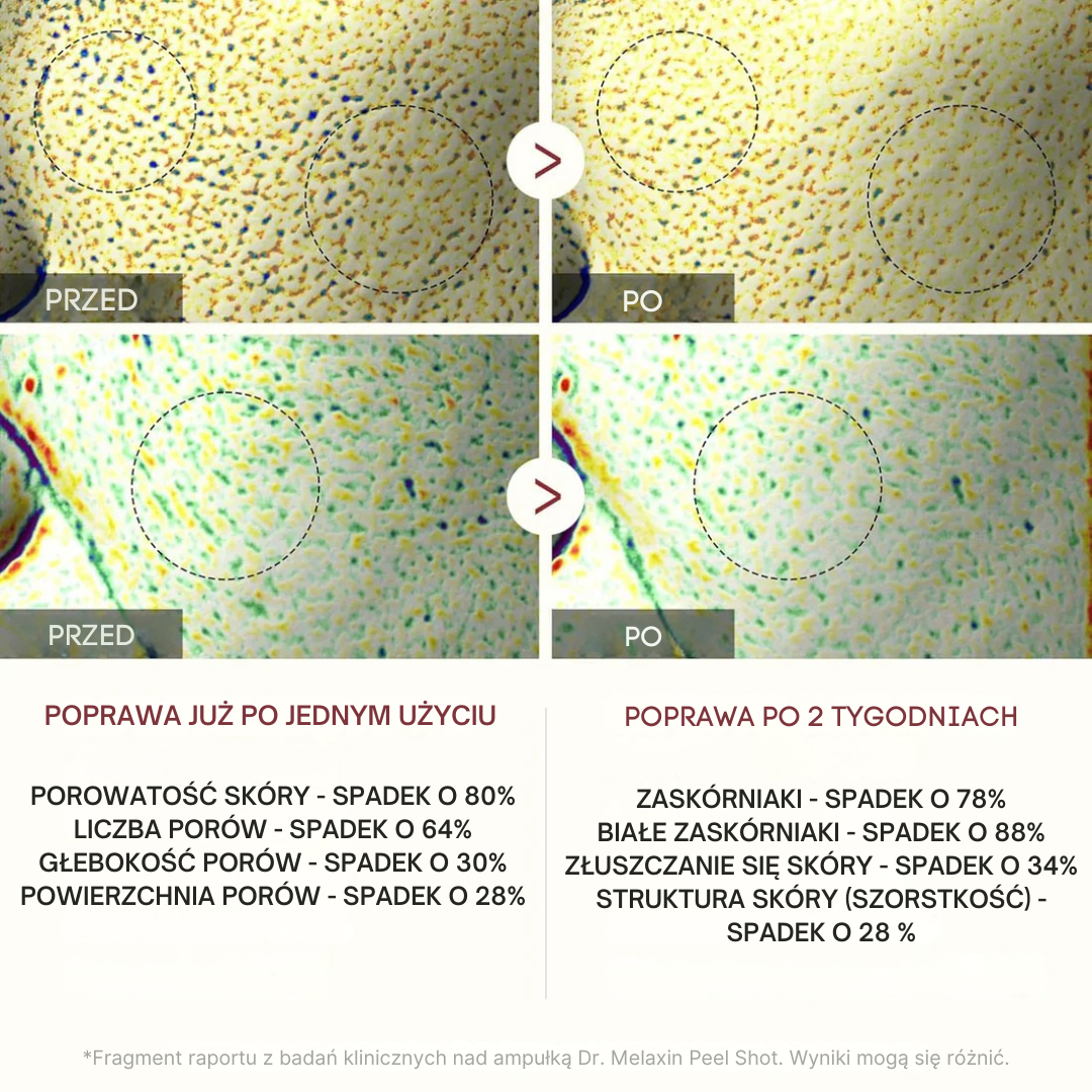 Dr.Melaxin - Peel Shot Rýžový Peeling