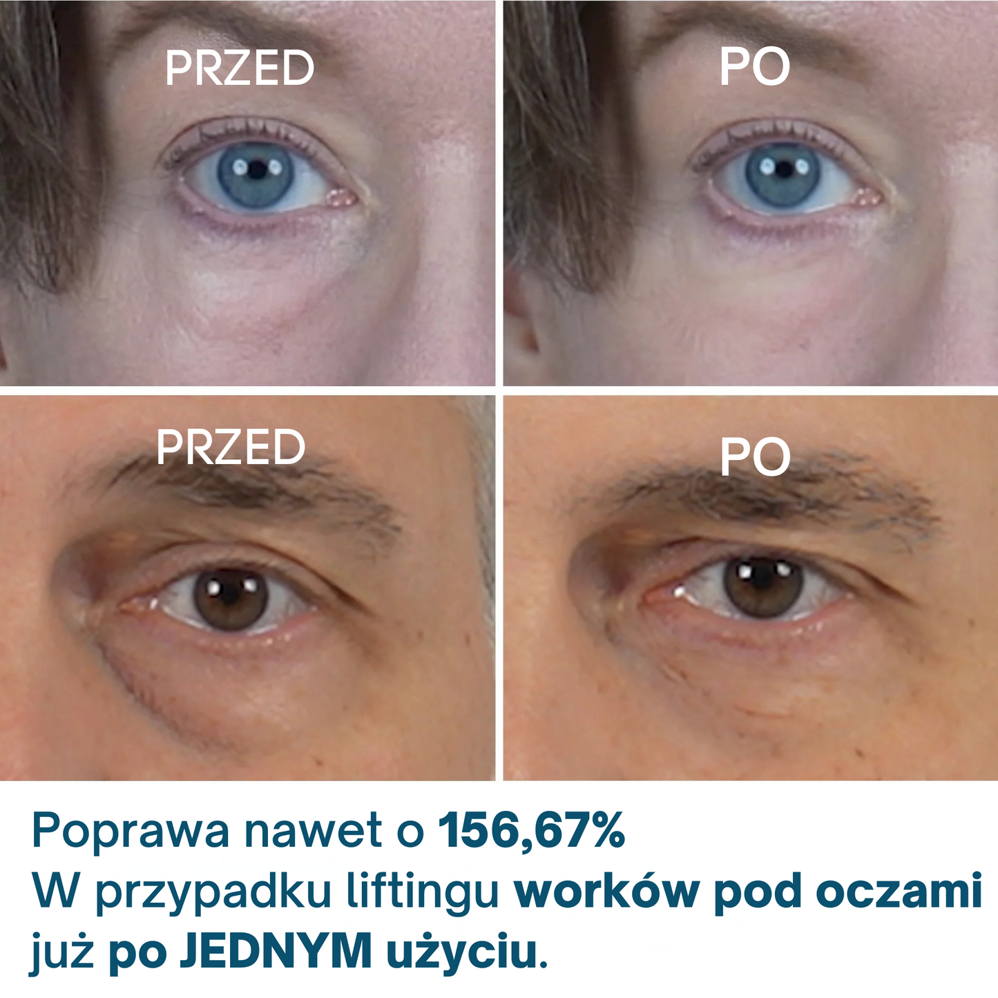 Dr.Melaxin Oogcrème Eyephalt