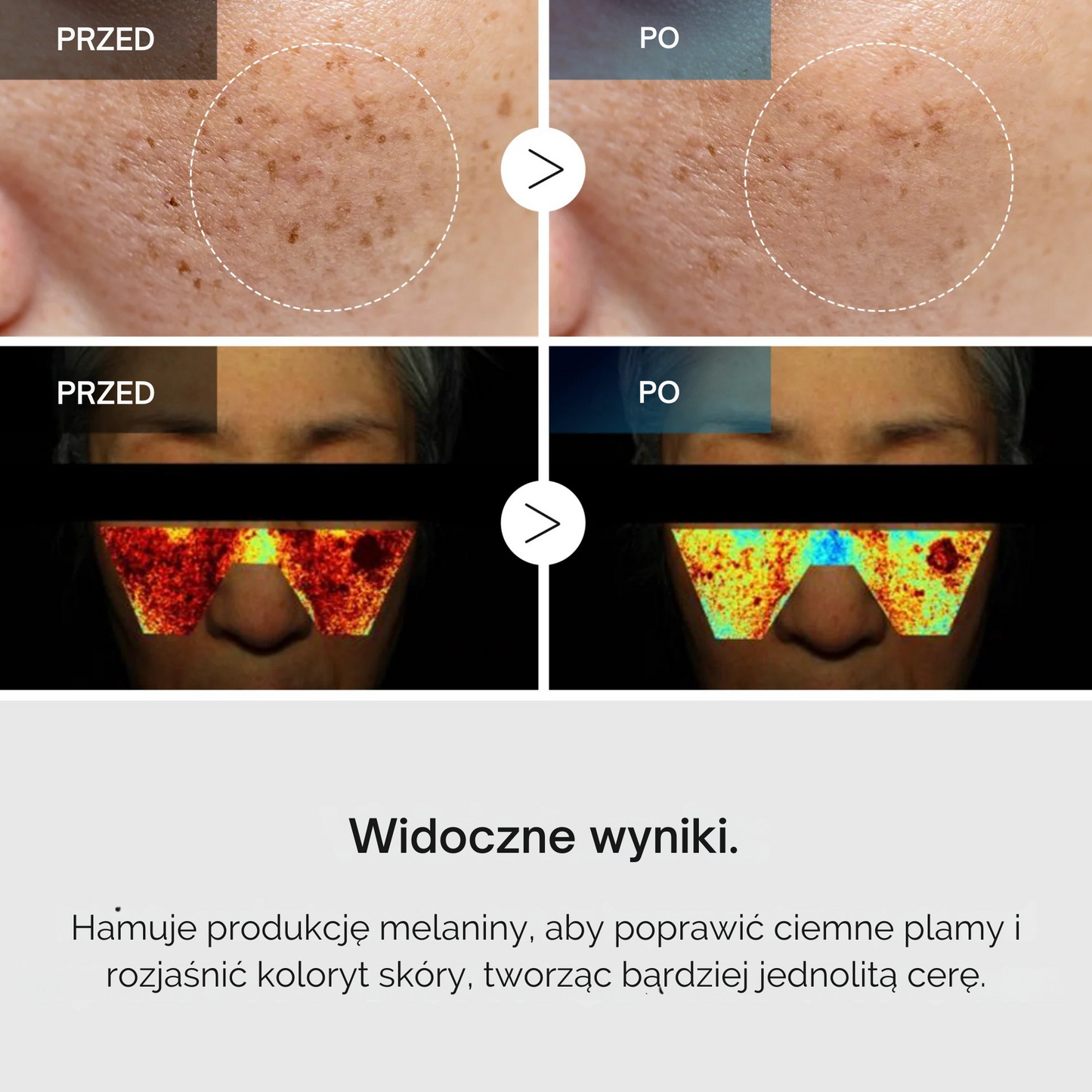 TX Tranexamová kyselina Péče o tmavé skvrny řada
