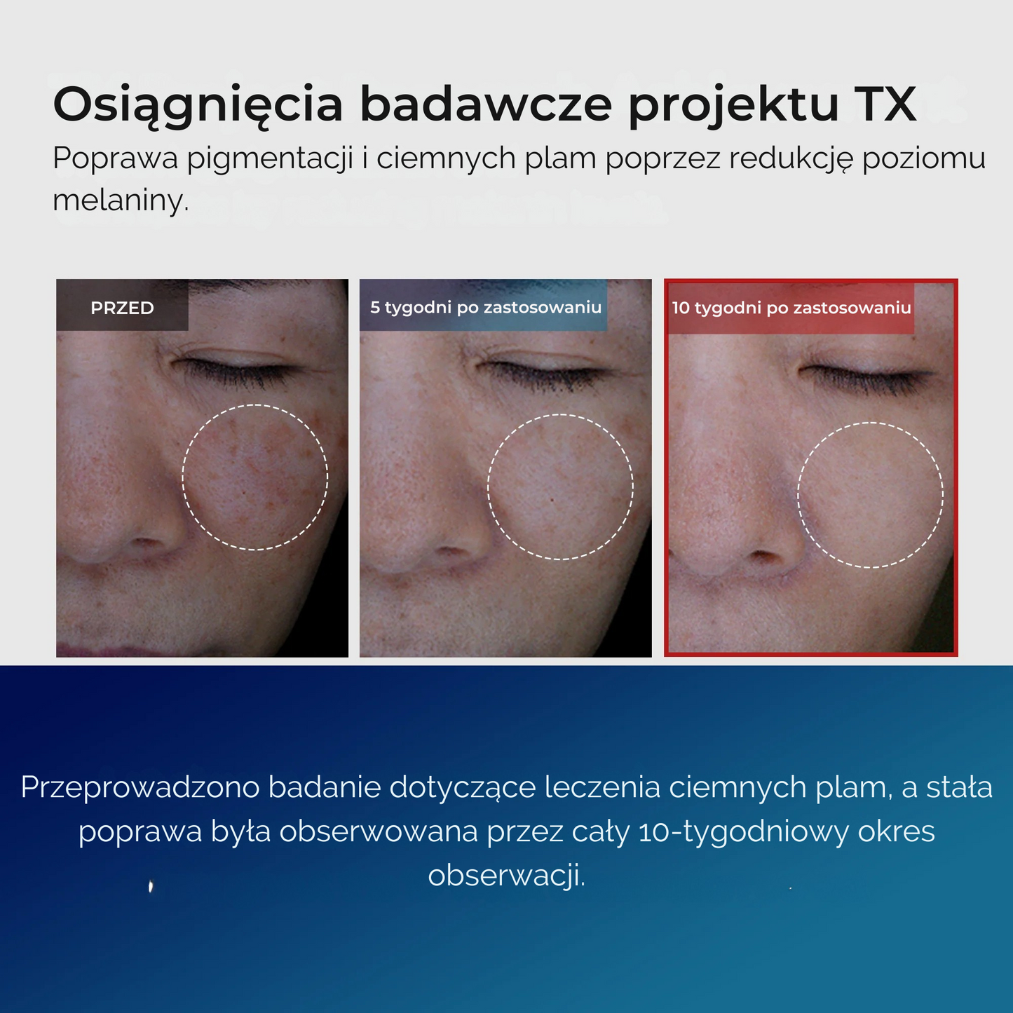 TX Tranexamová kyselina Péče o tmavé skvrny řada