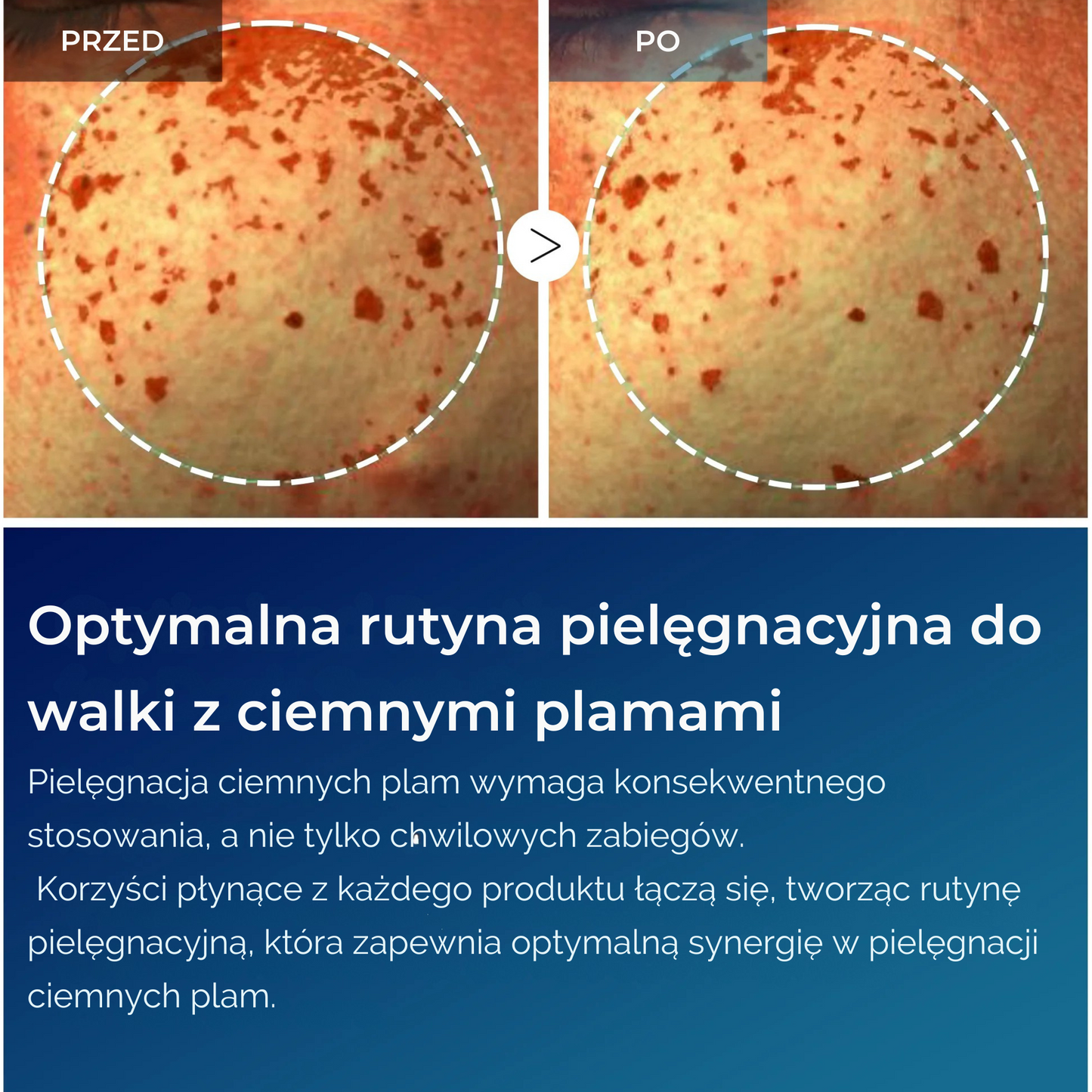 TX Tranexamová kyselina Péče o tmavé skvrny řada