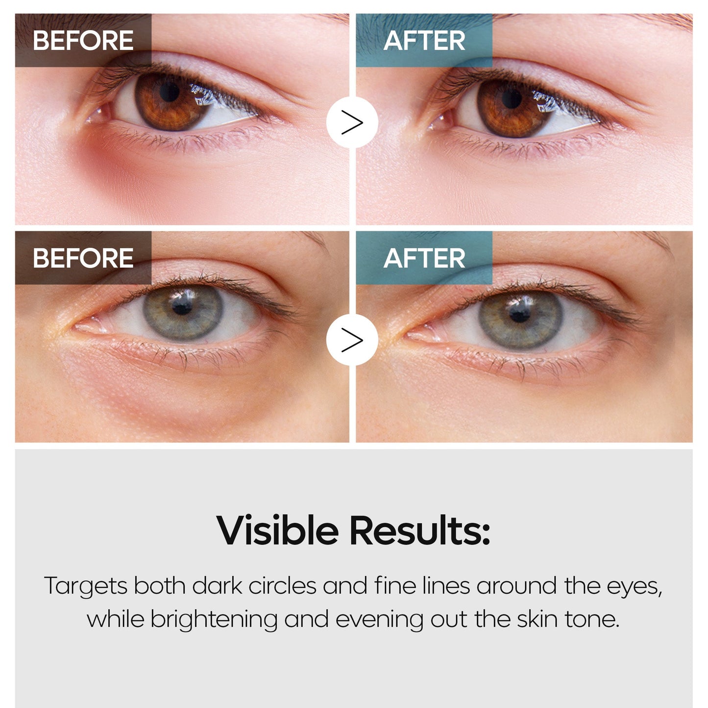 TX Retinalsome Doppelwirkungs-Augencreme