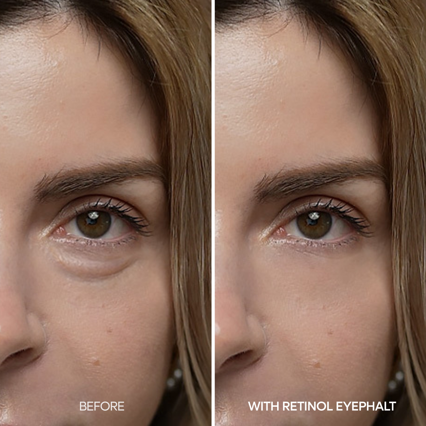 [Tag und Nacht] Eyephalt Augenlifting-Linie gegen Tränensäcke