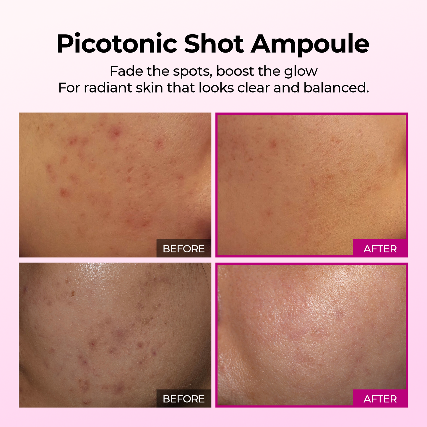 Ampule na pigmentaci Picotonic Shot