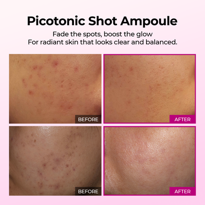 Ampule na pigmentaci Picotonic Shot