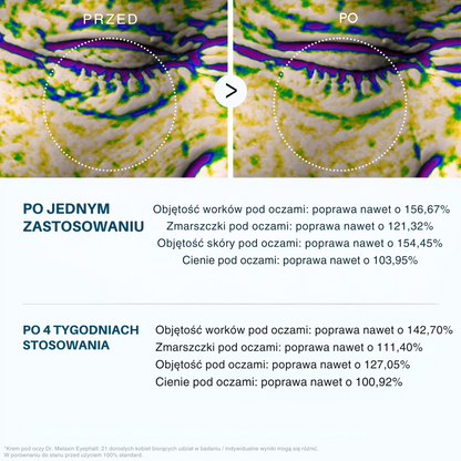 Dr.Melaxin Oční krém Eyephalt
