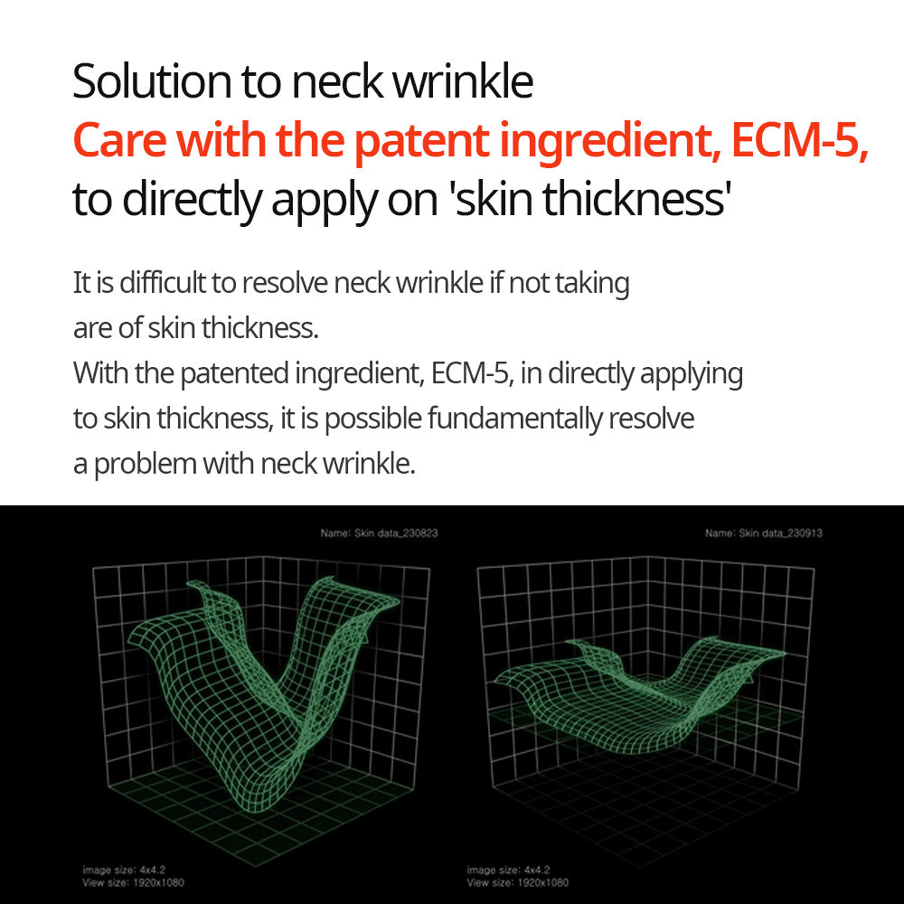 Linie zur Straffung des Halses Necksphalt ECM