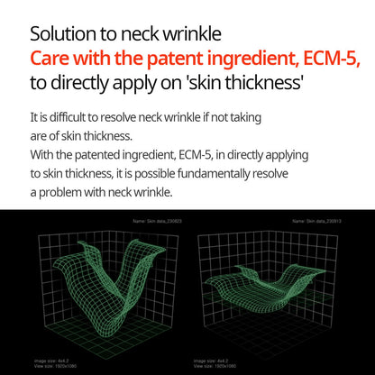 Linie zur Straffung des Halses Necksphalt ECM