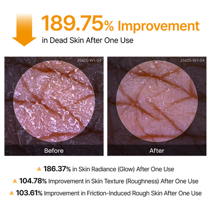 Spray zur Keratinpflege Peel Shot Kojic Acid Kurkuma